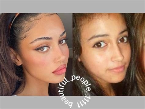 Cindy Kimberly Before and After Plastic Surgery: Lips, Nose, Face